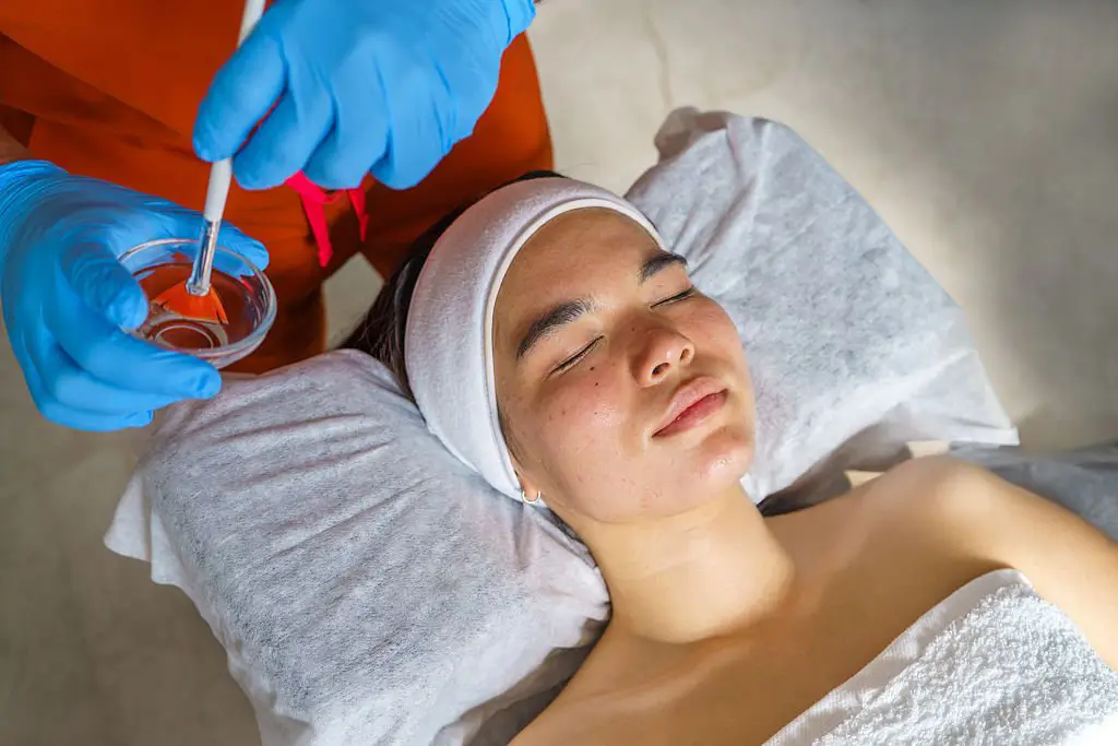 chemical peel skin rejuvenation treatment