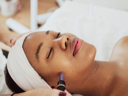 microneedling-3