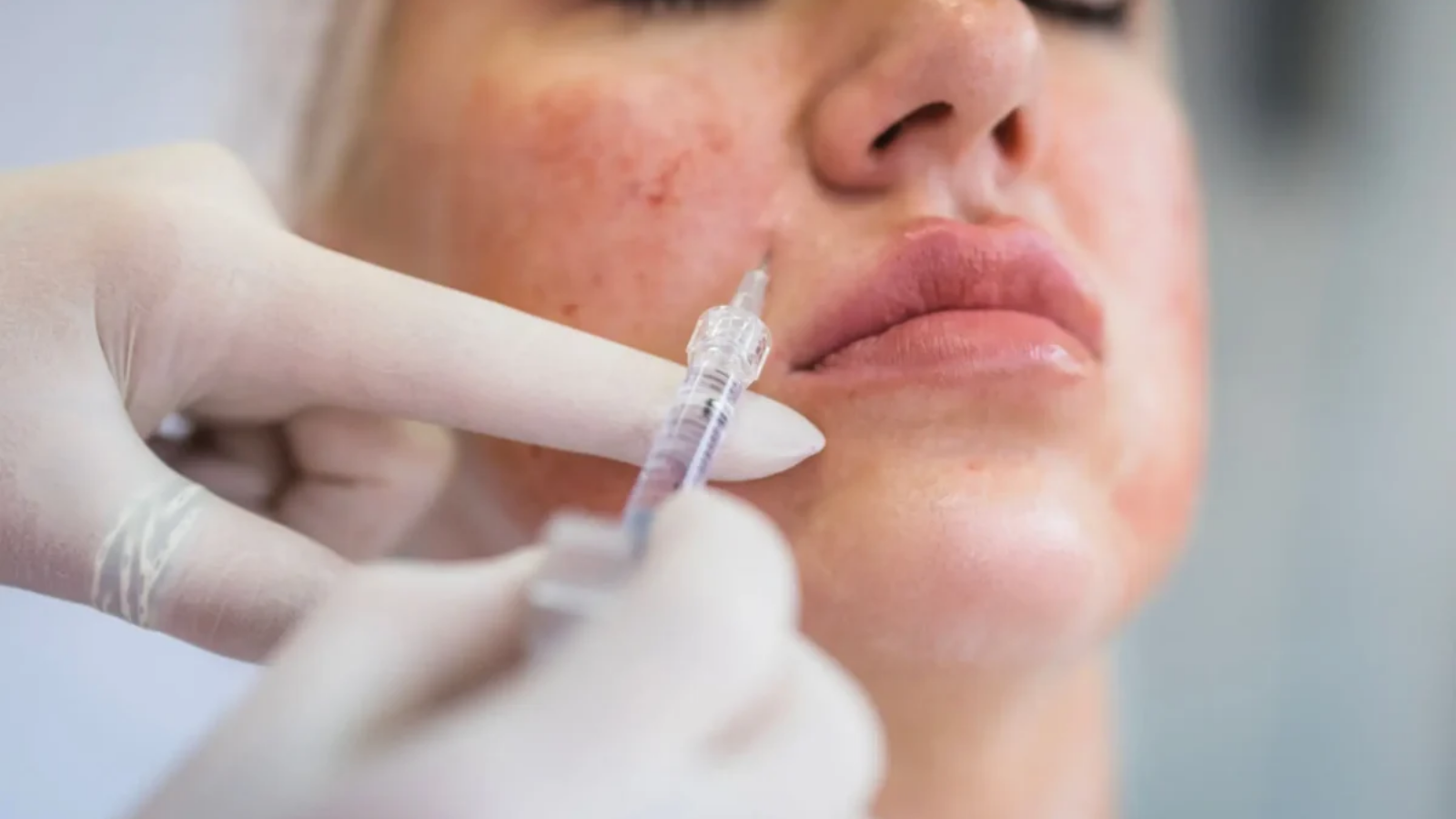 skin-booster
