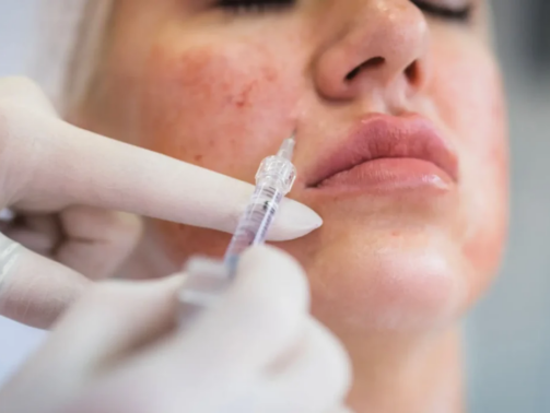 skin-booster