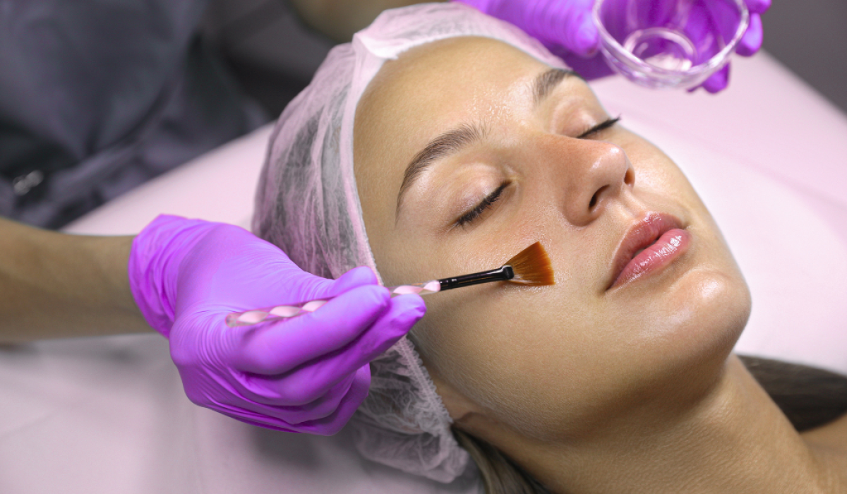 Lady Receiving chemical peel treatment at Fifth Sense Clinic Cheadle Hulme, Manchester